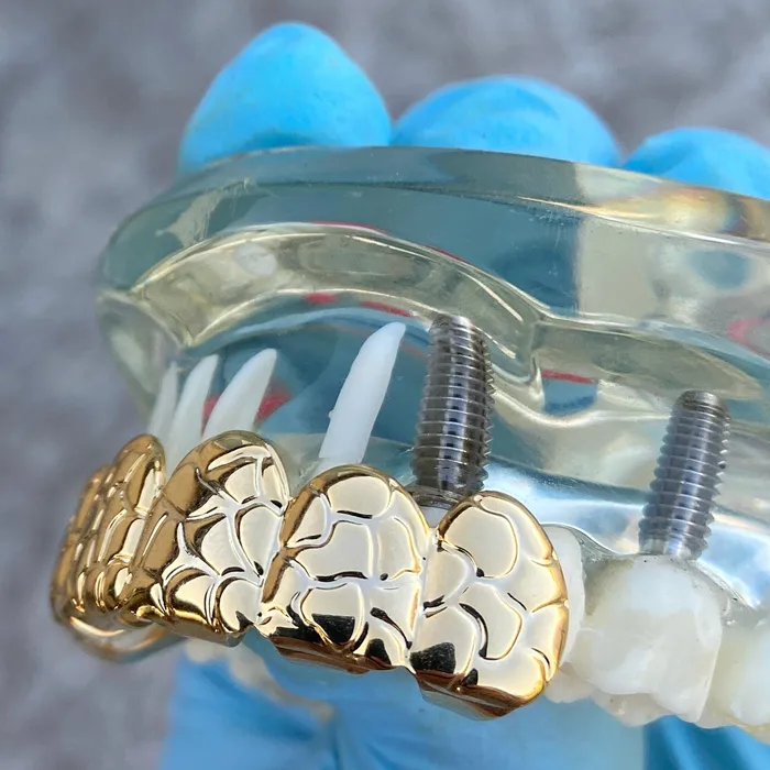 14k Gold Plated Deep Nugget Cut Grillz Top Six Teeth Grills Sungshin Metal Earrings 14k Gold Plated Deep Nugget Cut Grillz Top Six Teeth Grills Sungshin Metal Earrings