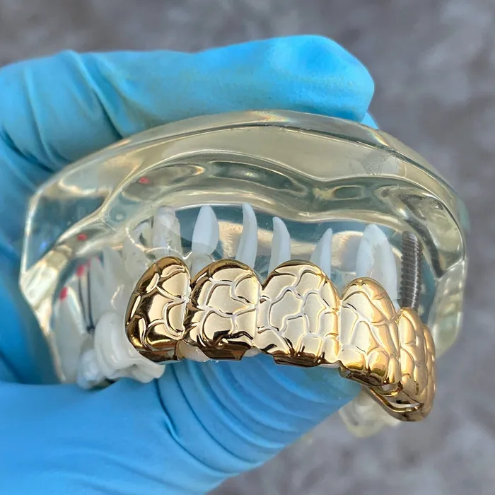 14k Gold Plated Deep Nugget Cut Grillz Top Six Teeth Grills Sungshin Metal Earrings 14k Gold Plated Deep Nugget Cut Grillz Top Six Teeth Grills Sungshin Metal Earrings