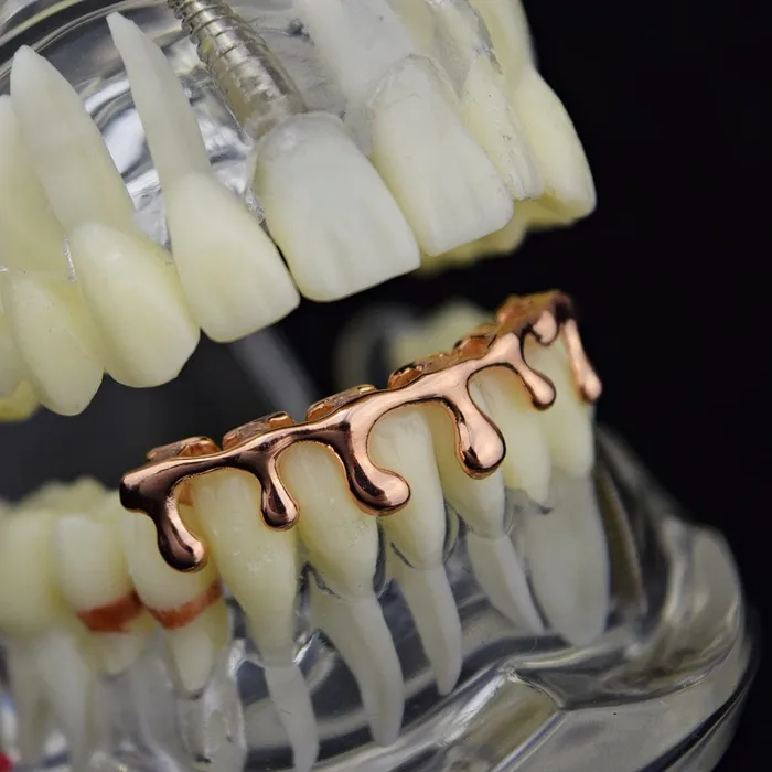 Bling Cartel Admin 14K Rose Gold Plated Drip Bottom Teeth Grillz Earrings