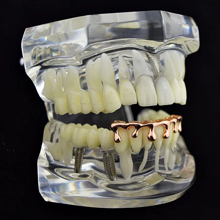 Bling Cartel Admin 14K Rose Gold Plated Drip Bottom Teeth Grillz Earrings