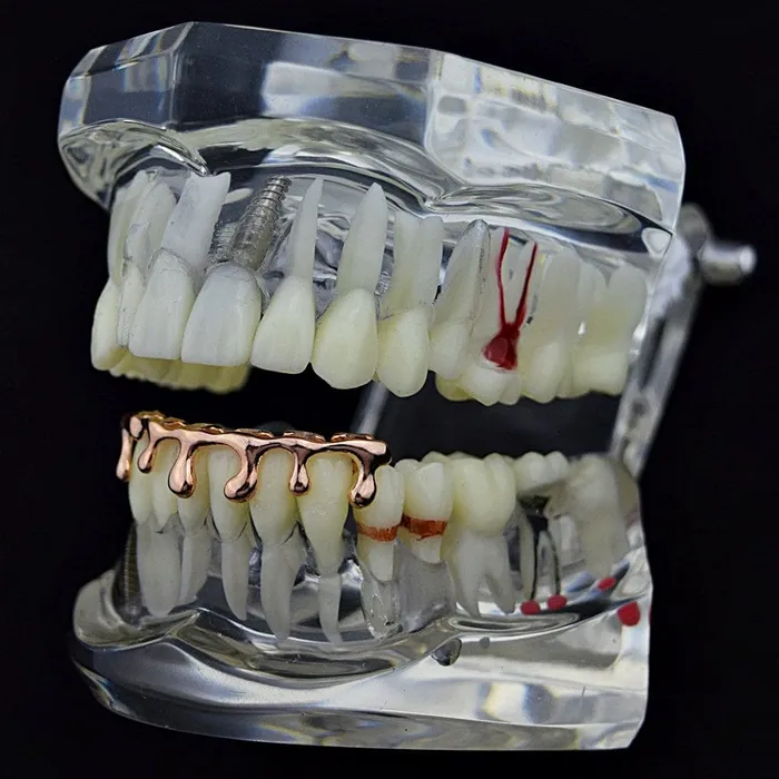 Bling Cartel Admin 14K Rose Gold Plated Drip Bottom Teeth Grillz Earrings