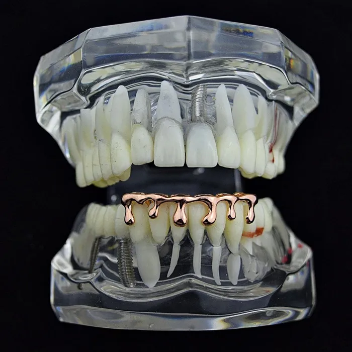 Bling Cartel Admin 14K Rose Gold Plated Drip Bottom Teeth Grillz Earrings