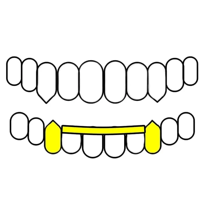 Bling Cartel Admin Rings Real 10K Gold TwoTone Diamond Dust Vampire Fangs Custom Grillz