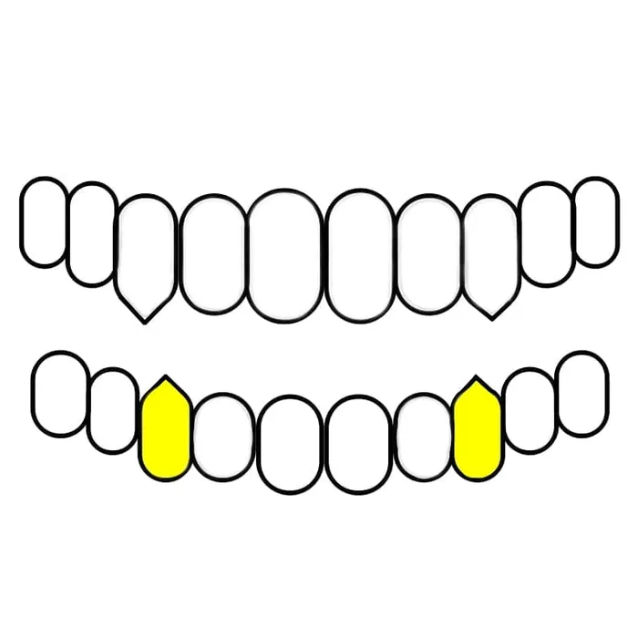 Bling Cartel Admin Rings Real 10K Gold TwoTone Diamond Dust Vampire Fangs Custom Grillz