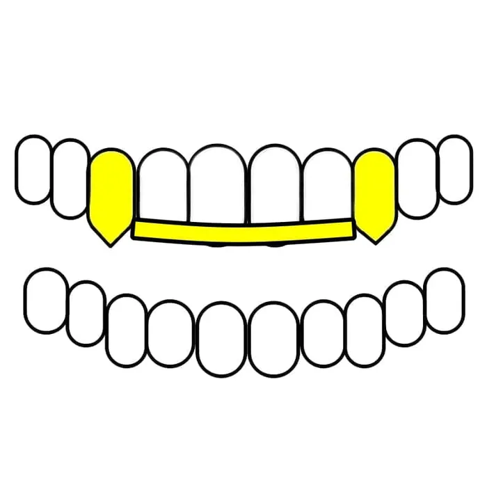Bling Cartel Admin Rings Real 10K Gold TwoTone Diamond Dust Vampire Fangs Custom Grillz