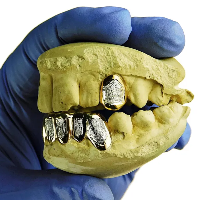 Real 10K Gold TwoTone Diamond Dust 26 Custom Grillz Bling Cartel Admin Rings