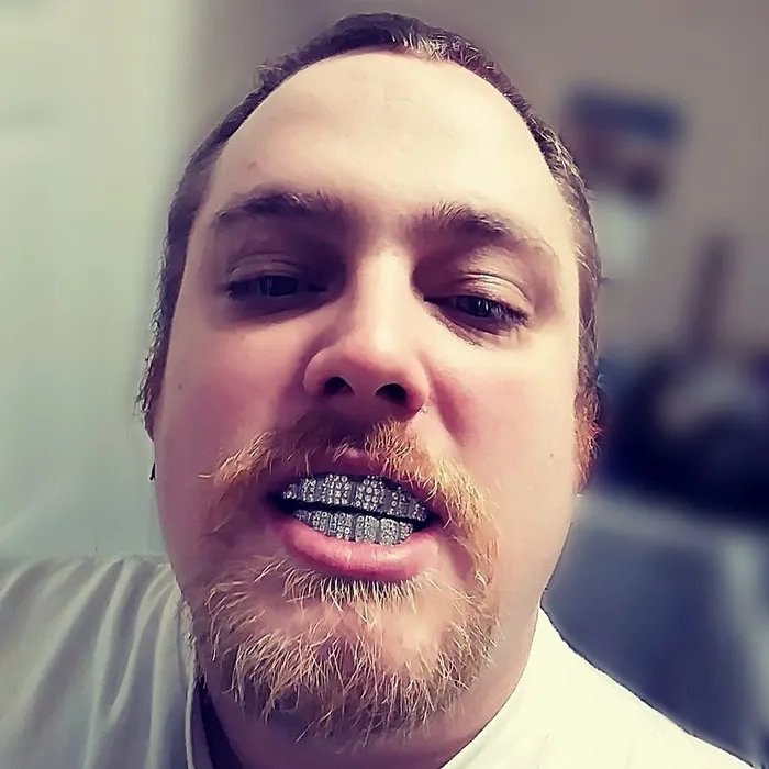 Rings Bling Cartel Admin Silver Tone CZ Iced Six on Six Teeth Grillz Set